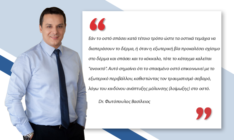 κάταγμα οστού