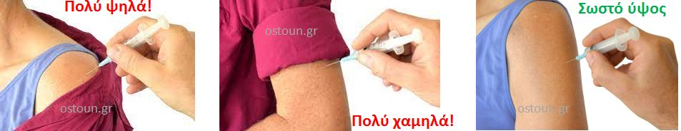 Πόνος στον ώμο μετά το εμβόλιο